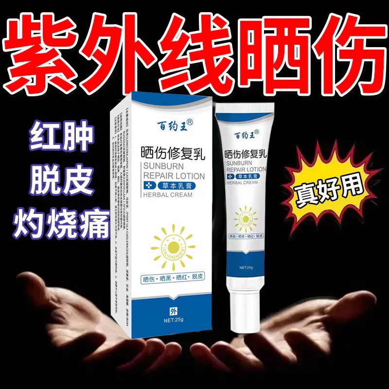 皮肤晒伤修复药膏紫外线过敏胳膊皮肤红肿刺痛发痒脱皮男女专用霜