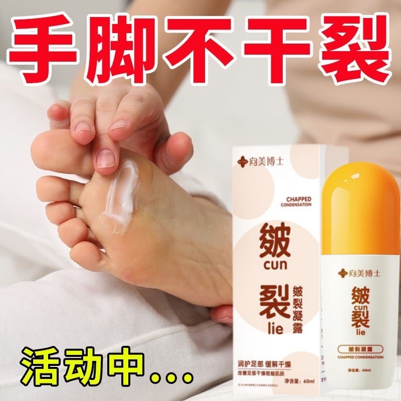 手开裂皲裂凝露愈脚后跟干裂手干裂手脚干裂脱皮粗糙治手裂的药膏