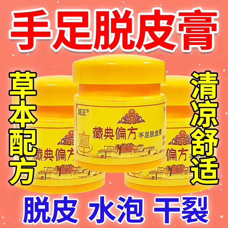手脱皮真菌感染脱皮膏季节性手脱皮手足脱皮手脚脱皮膏痒膏