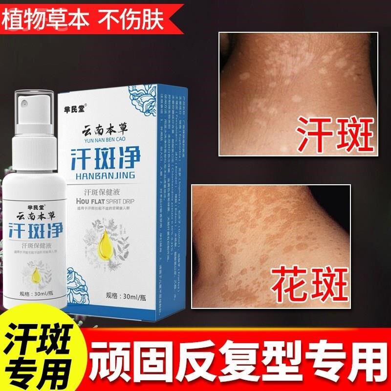云南本草专用汗斑净皮肤汉斑皂花斑藓膏汗斑香露去喷剂白斑外用药
