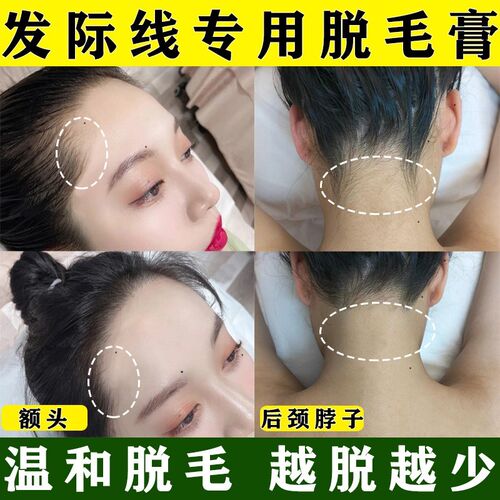发际线专用除毛膏脱额头后脖子美人尖耳边碎发鬓角汗毛发际线全身