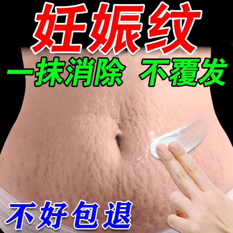 妊娠纹消除去妊娠纹紧致肚皮去肥胖纹大腿内侧生长纹去疤修复霜
