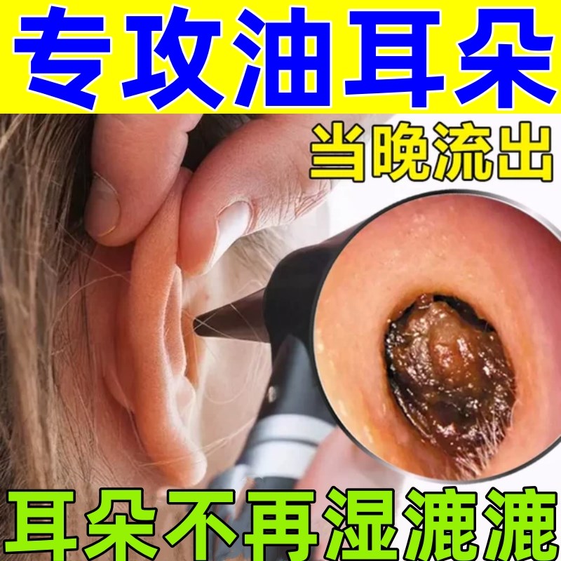 油耳朵清洁器治疗去油神器清理耳痒流脓流水耳耵软化专用滴耳液