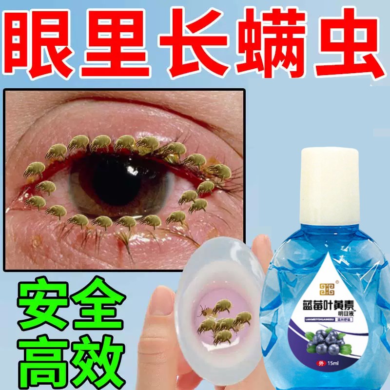 眼睛除螨洗眼液滴眼睛干涩发痒眼屎多痒眼睑清洁去螨虫眼液