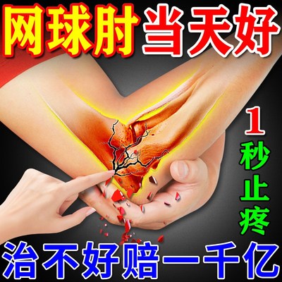 网球肘克星专用药进口治疗胳膊手肘关节疼痛神器网球肘特效药贴膏