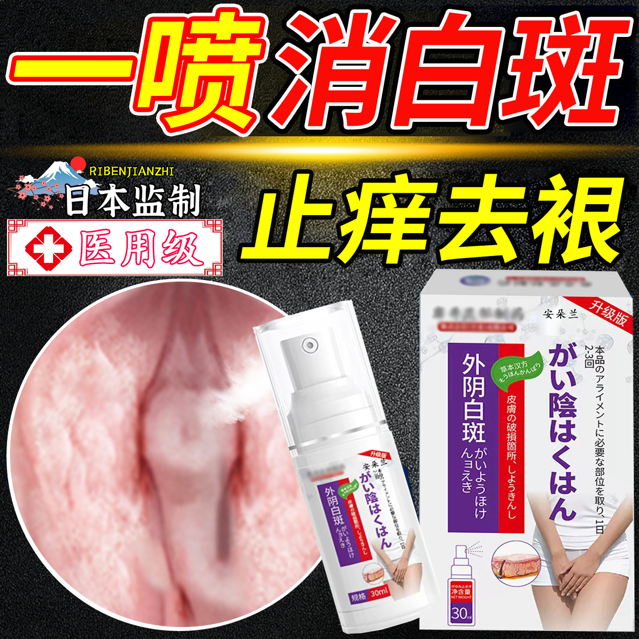 外阴白斑专用止痒去萎缩瘙痒根药膏冰白黄体酮软膏治营养不良疗FF