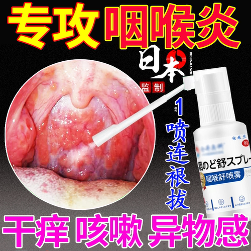 【日本技术】咽炎干痒咳嗽异物感