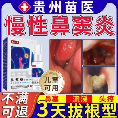 【贵州苗医】鼻窦炎鼻涕倒流专用