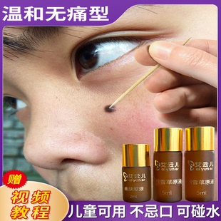 水美容院金水身上雀斑药水斑点脸部志黑点膏药痦子 点斑水家用正品