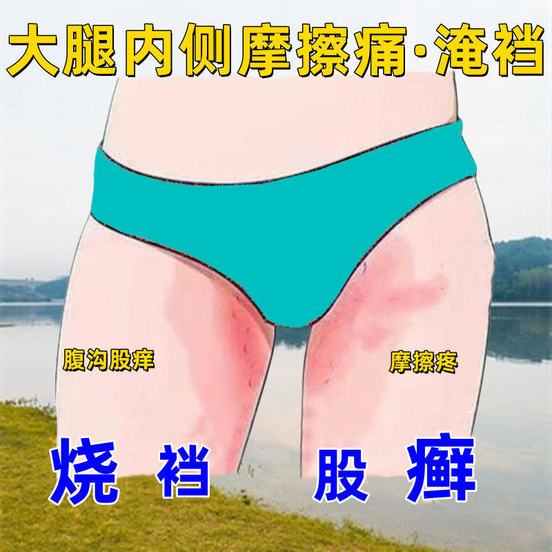 【烧裆】大腿内侧摩擦痛红肿股藓大腿根部淹红潮湿腹沟股痒汗磨伤