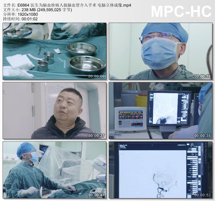 医生为脑血栓病人做脑血管介入手术电脑立体成像 实拍视频素材