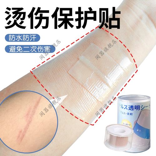 烫伤保护贴小伤口洗澡愈合贴儿童宝宝婴儿大人擦伤伤口遮挡防水贴