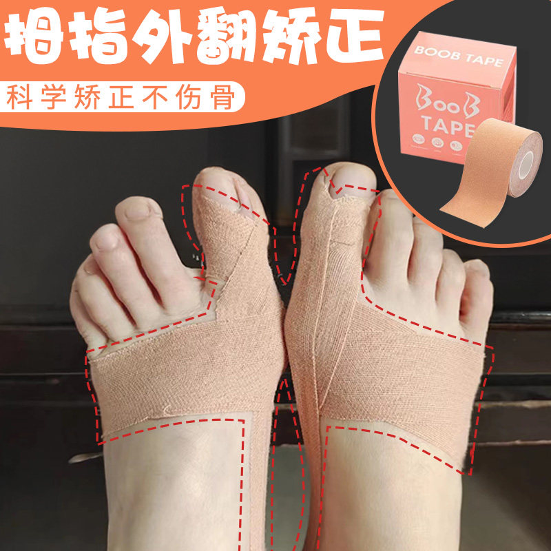 拇指外翻矫正器分趾器大母脚趾头足纠正脚大拇指上翘矫正器