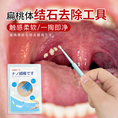 扁桃体结石去除工具家用扁桃体结石吸取器出隐窝神器扁桃体去异味