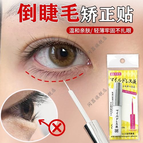 倒睫毛矫正贴成人低敏下眼睑倒睫老人眼皮下垂提拉眼贴专用神器