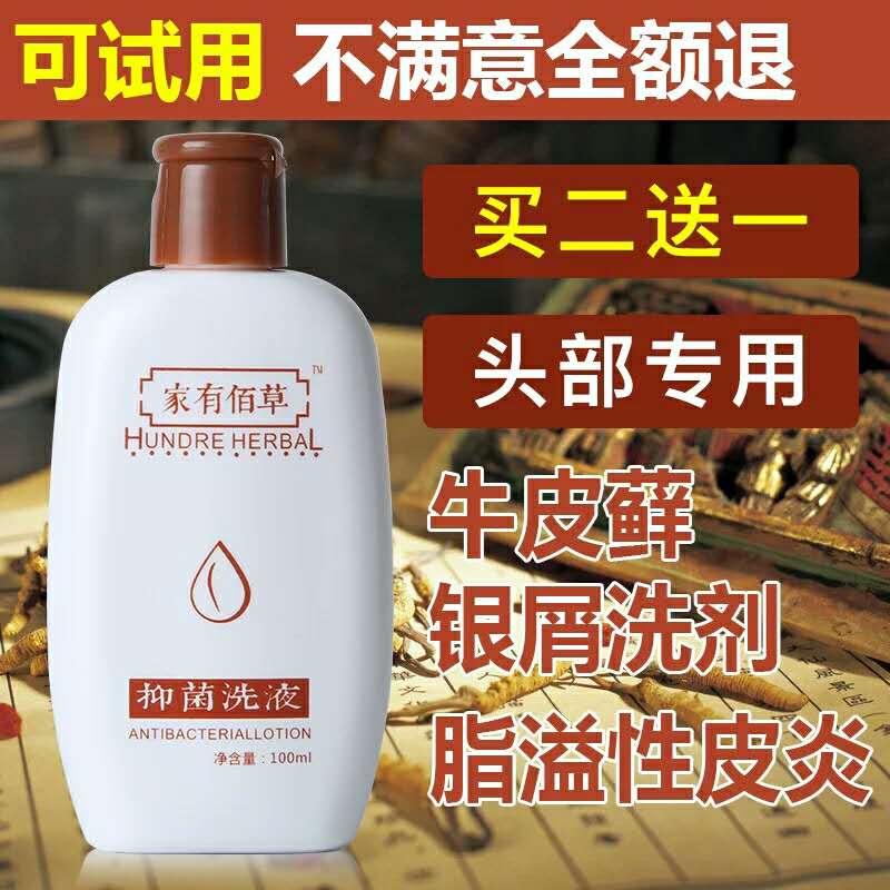 洗发水脂溢性皮炎头皮癣头部牛皮癣治银屑病止痒软膏头皮外用洗液