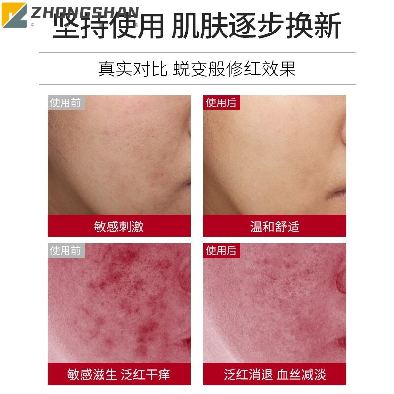 去红血丝修复角质层增厚敏感肌肤激素脸改善脸部泛红舒缓修护面霜