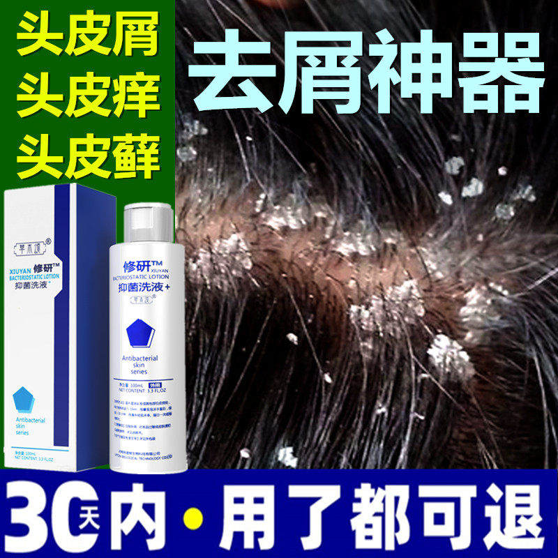 头皮清洁去大块头皮屑神器除头螨癣去头皮屑去屑止痒抗真菌洗发水