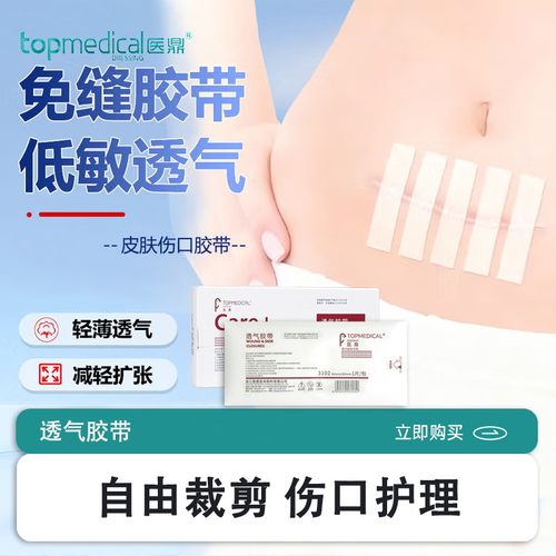 医鼎（top medical）透气胶带创面防粘连拉合减张胶布贴固定敷料
