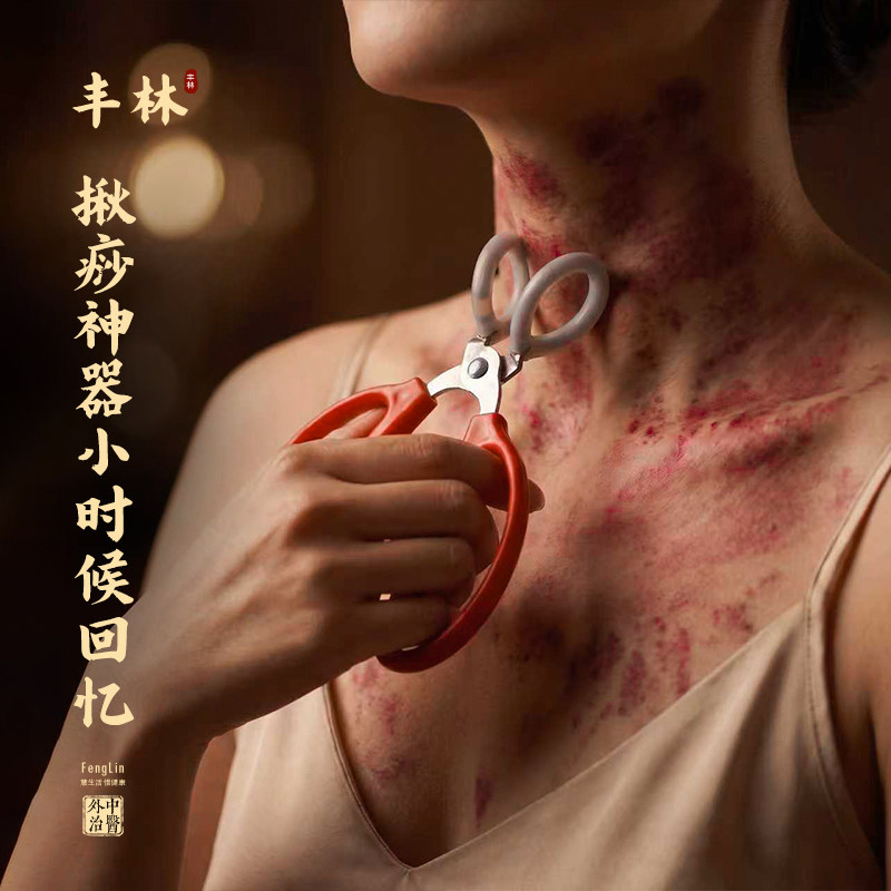 不锈钢刮痧板四肢腿部刮痧双环夹头长柄握稳日常放松居家护理自用