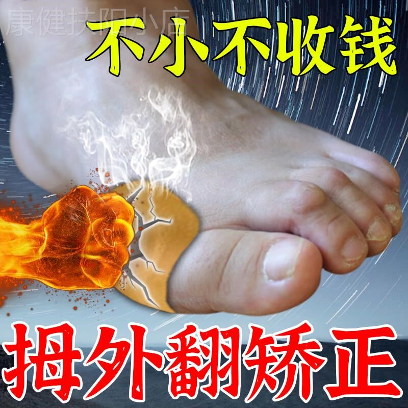 拇外翻贴膏拇囊炎疼痛拇指变形重叠大脚骨突出大拇指外翻矫正神器