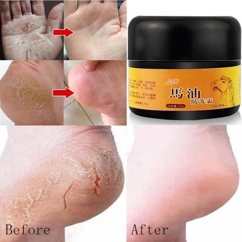 Horse Oil Feet Care Cream Beriberi Cream for Athlete's Foot