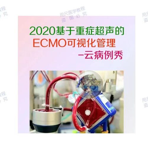 无重症超声ecmo可视化管理
