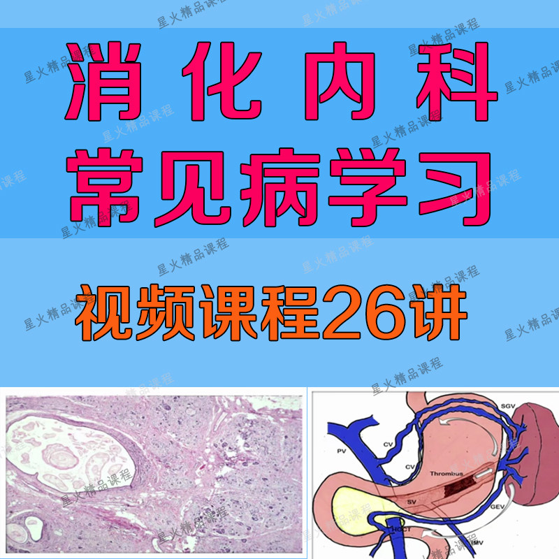消化内科常见病学习视频课程慢性胰腺胃阑尾炎大肠结直肠食管病