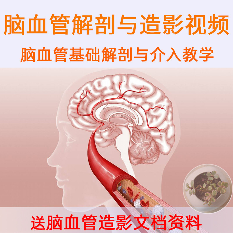 颅脑脊髓血管解剖脑血管造影介入视频教程脑血管介入围术期并发症