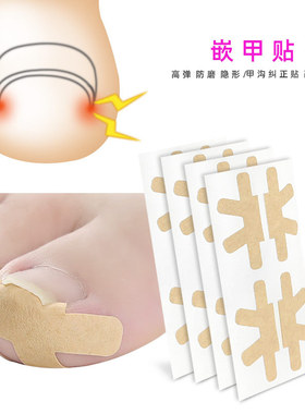 Toenail Corrector Patch Ingrown Toenail Corrector Stickers