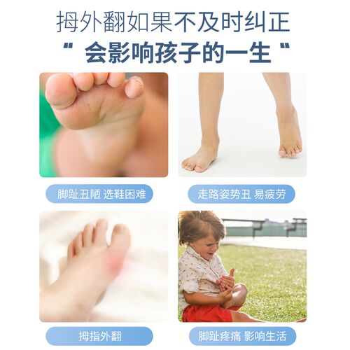德国BORSU儿童拇指外翻矫正器脚趾矫正分趾器小孩大脚骨突出专用