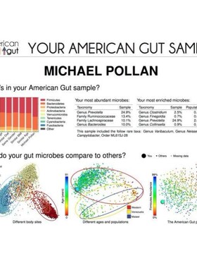 TCGA GEO数据挖掘单细胞测序转录组数据分析