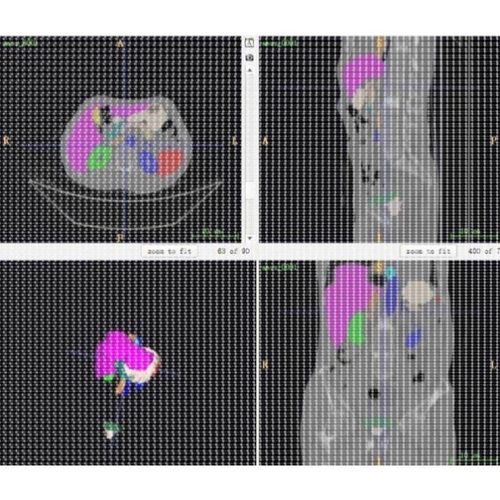 R语言机器学习单细胞多组学空间转录组深度学习基因组学10X差异