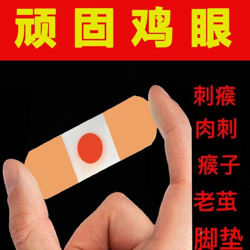 去除鸡眼贴老茧刺瘊刺窝脚钉脚茧脚垫鸡眼贴鸡眼膏除茧贴包邮