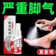 真菌脚气脚臭臭脚喷剂脚烂脚缝脚痒防止水泡脱皮喷雾脚趾止痒克星