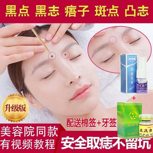 【美容院同款】药膏去脸上雀斑黑点痦子笔神器药水不留疤
