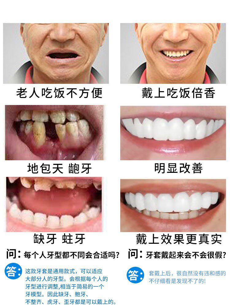 日本品质仿真假牙套牙老人没牙专用吃饭神器可咀嚼临时牙套美白牙