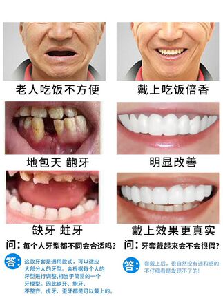 日本品质仿真假牙套牙老人没牙专用吃饭神器可咀嚼临时牙套美白牙