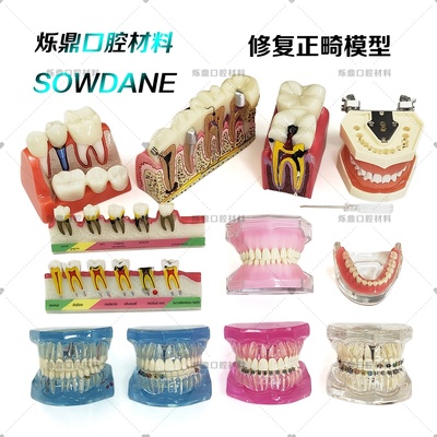 牙科4倍比例龋齿病理模型横截面