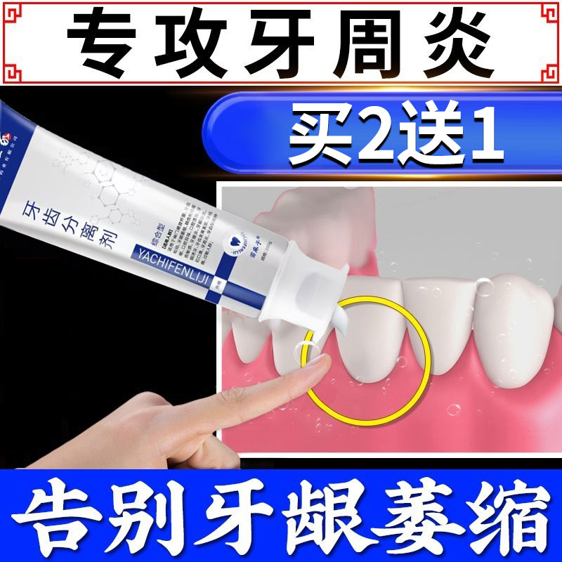 牙周炎/牙龈萎缩/牙齿松动