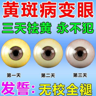 去除眼底黄斑病变眼药水眼睛发黄混浊眼白出血眼球干涩发痒叶黄素