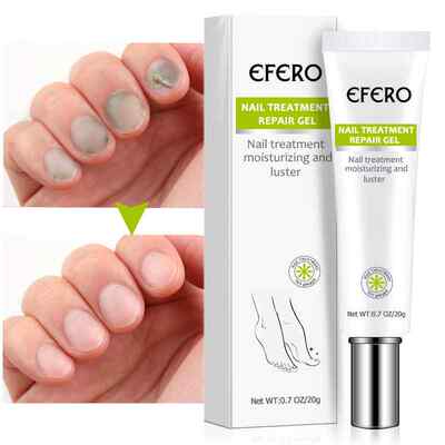 Anti Fungal Nail Repair Gel Treatment Anti Infection Serum O