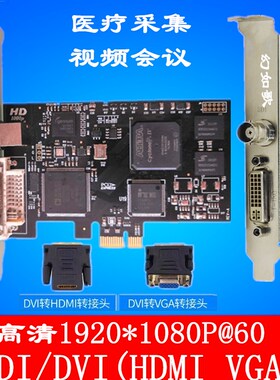 SDI DVI HDMI VGA 超声内窥镜医疗工作站VT333高清采集卡
