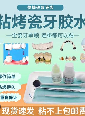 自己粘烤瓷牙全瓷金属连桥冠
