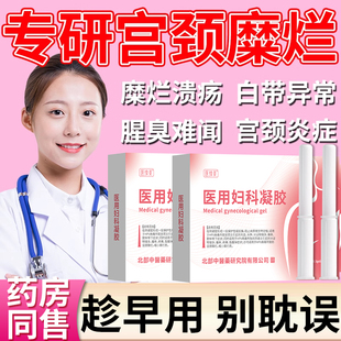 重度宫颈糜烂出血炎症白带多发黄有异味专用妇科凝胶中药房同售VQ