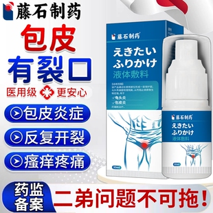 龟头炎包皮开裂发炎裂口专用糖尿病真菌感染瘙痒红肿皲裂包皮炎VQ