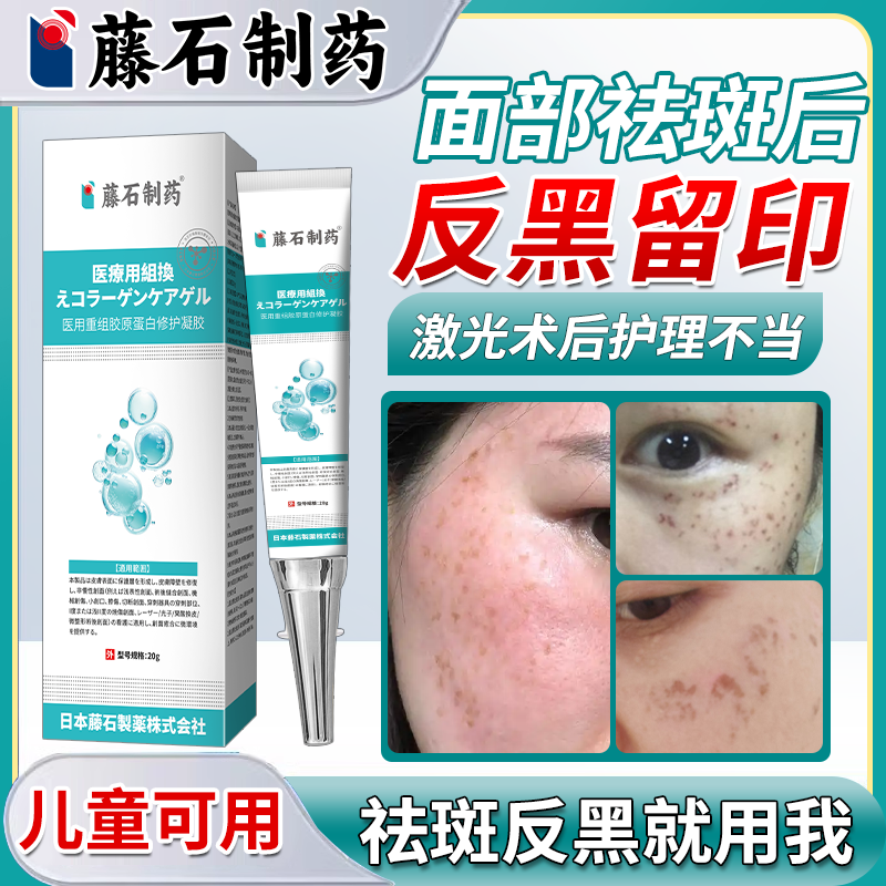 温和不刺激--祛斑后反黑专用