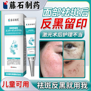 激光祛斑后反黑修复脸上黑斑去疤印去黑色素沉淀分解医用型除膏VQ