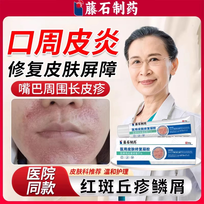 口周皮炎嘴巴周围红斑丘疹瘙痒过敏起皮专用唇周炎药房同款膏WQ
