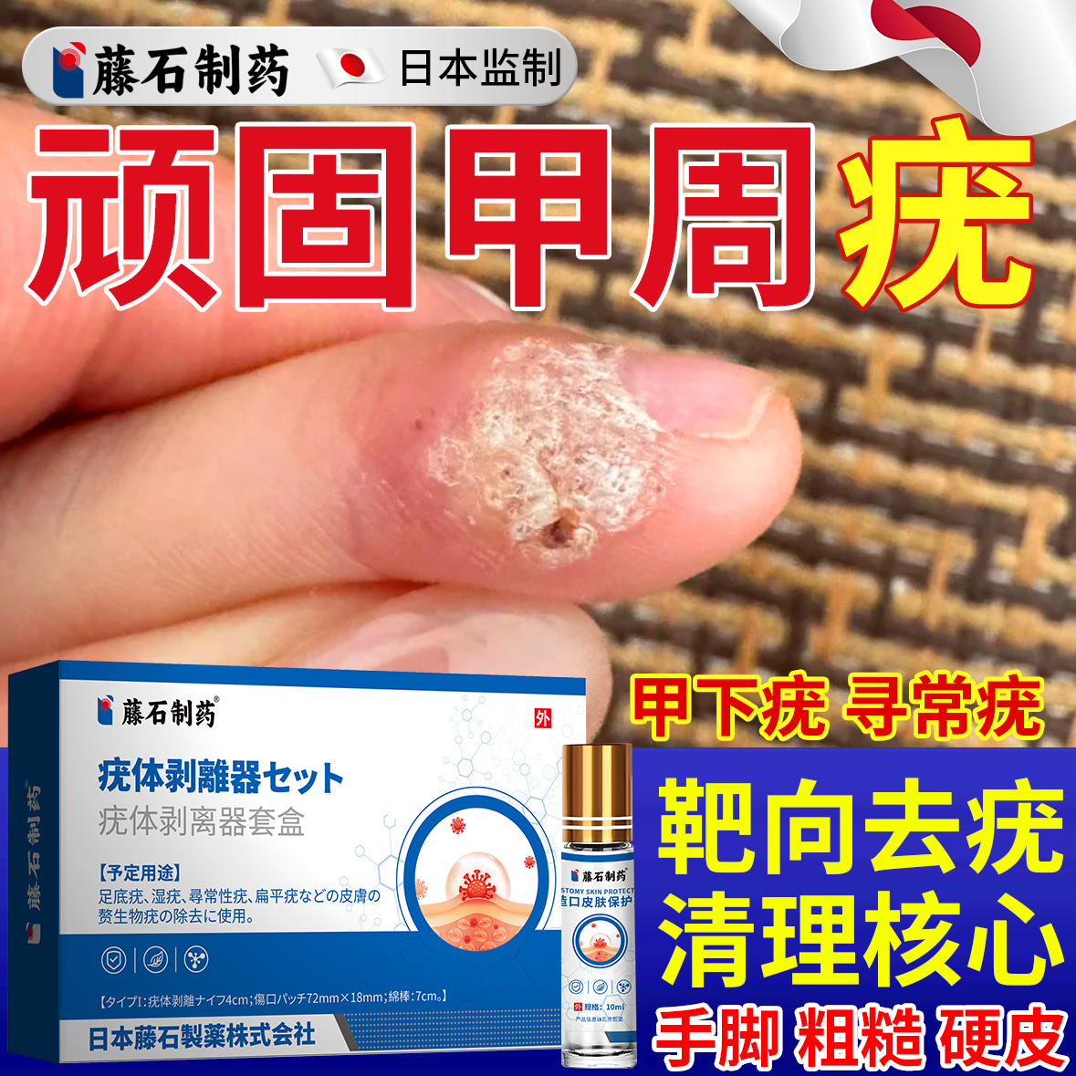 藤石制药甲周疣-疣体剥离套盒